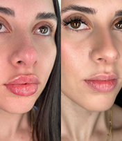 Before and after beauty visualization